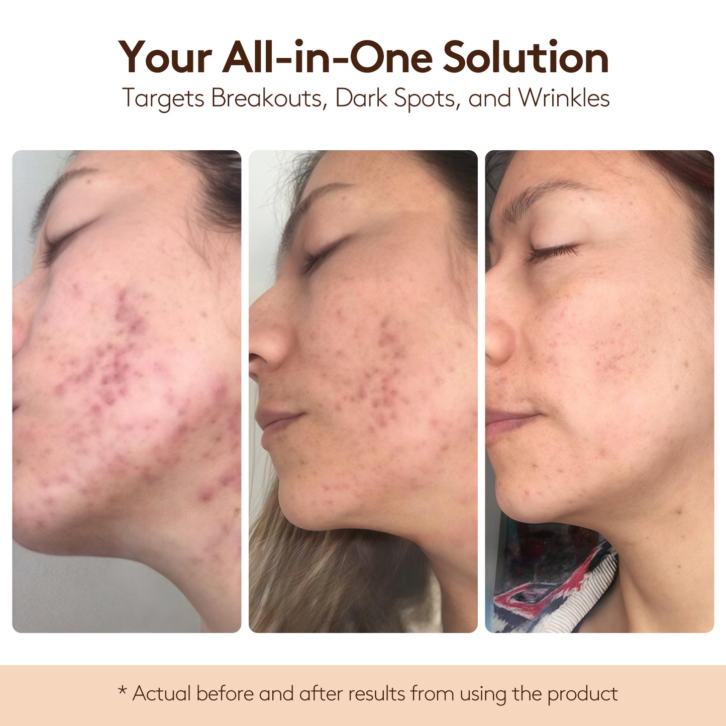 DL-Mandelic Acid Facial Renewal Ampoule