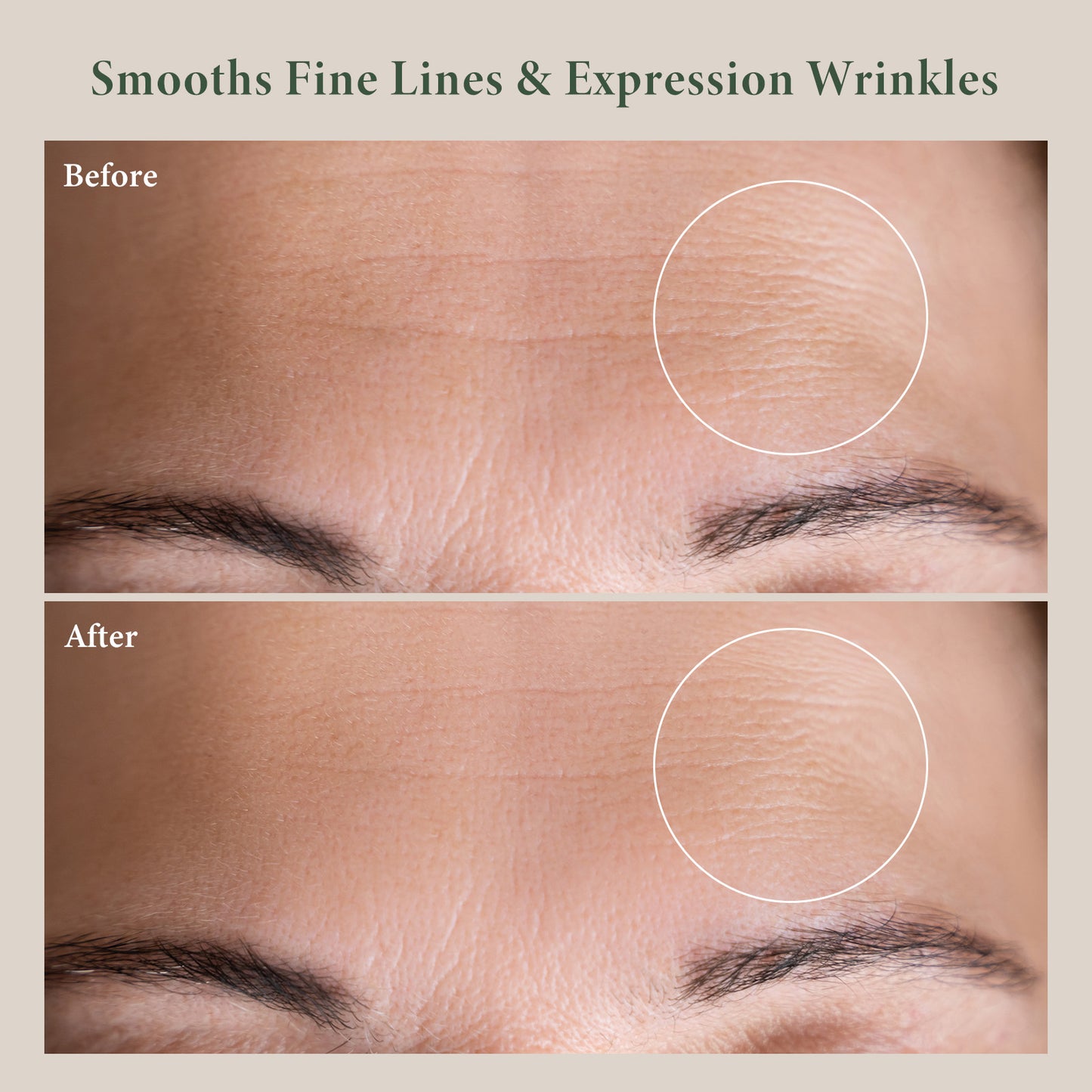 8-Oligopeptide Facial Anti-aging Ampoule
