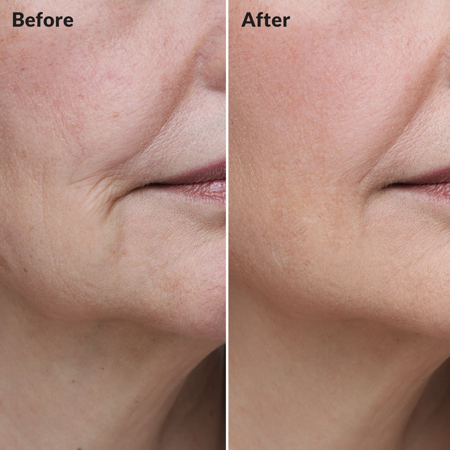 Golden Placenta Ultra Cream - Anti-Aging Facial Moisturizer