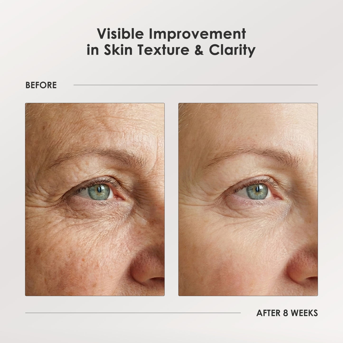 DL-Mandelic Acid Facial Renewal Ampoule